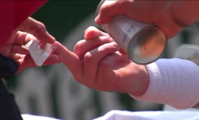 Ampoule au doigt pour Wawrinka qui vient de recevoir un traitement médical